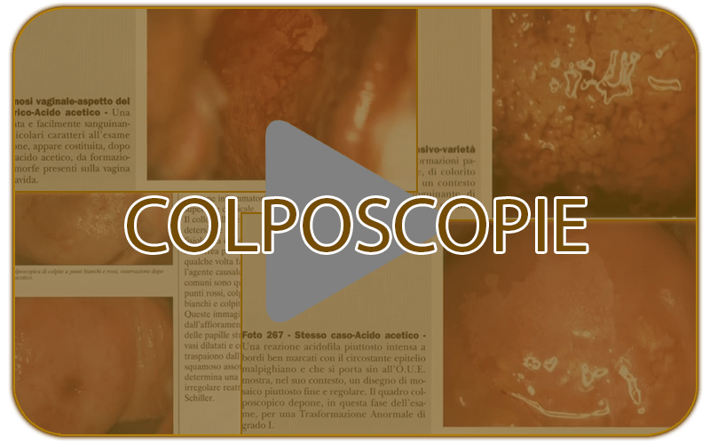 Colposcopie
