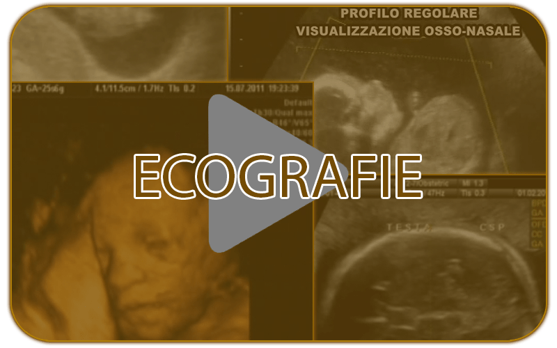 Ecografie